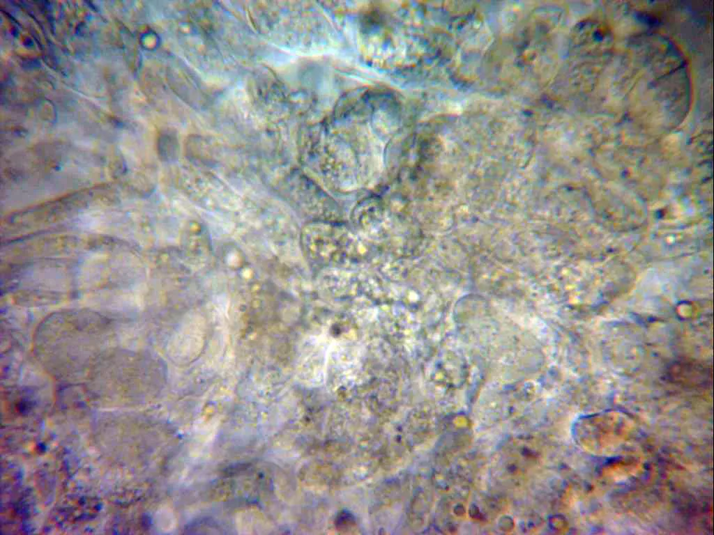Microscopía de Pyronema domesticum - 12 - Excípulo